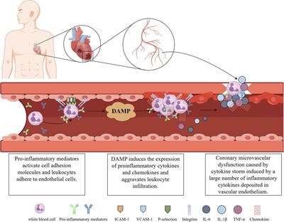 Inflammation and coronary microvascular disease: relationship, mechanism and treatment